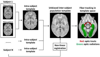 Progression of Visual Pathway Degeneration in Primary Open-Angle Glaucoma: A Longitudinal Study